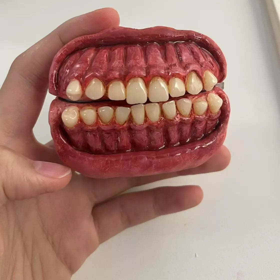 Red Gums & Teeth AirPods Case